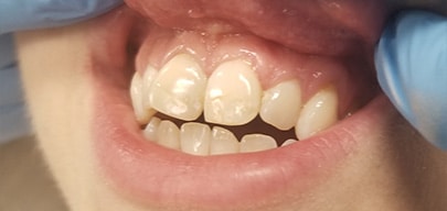 Before