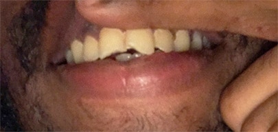 Before