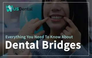 Everything You Need To Know About Dental Bridges Featured Image