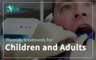 Fluoride Treatments For Children And Adults Featured Image