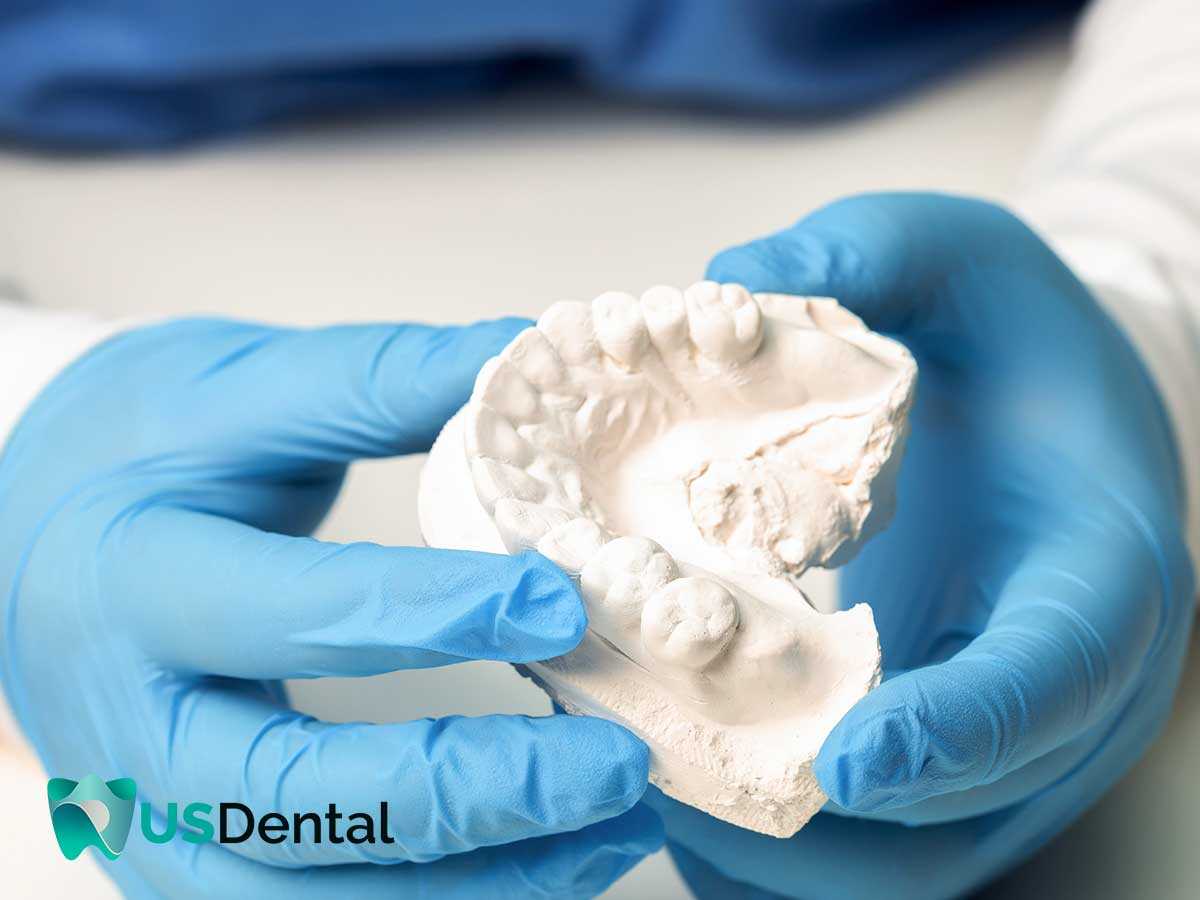 Professional Ohio Dentists Explain The Various Advantages Of Immediate Dentures