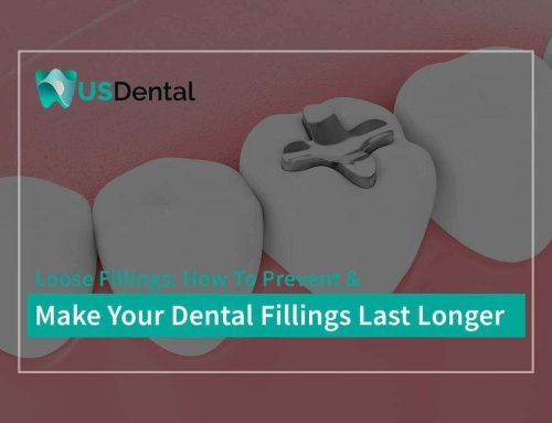 Loose Fillings: How To Prevent & Make Your Dental Fillings Last Longer