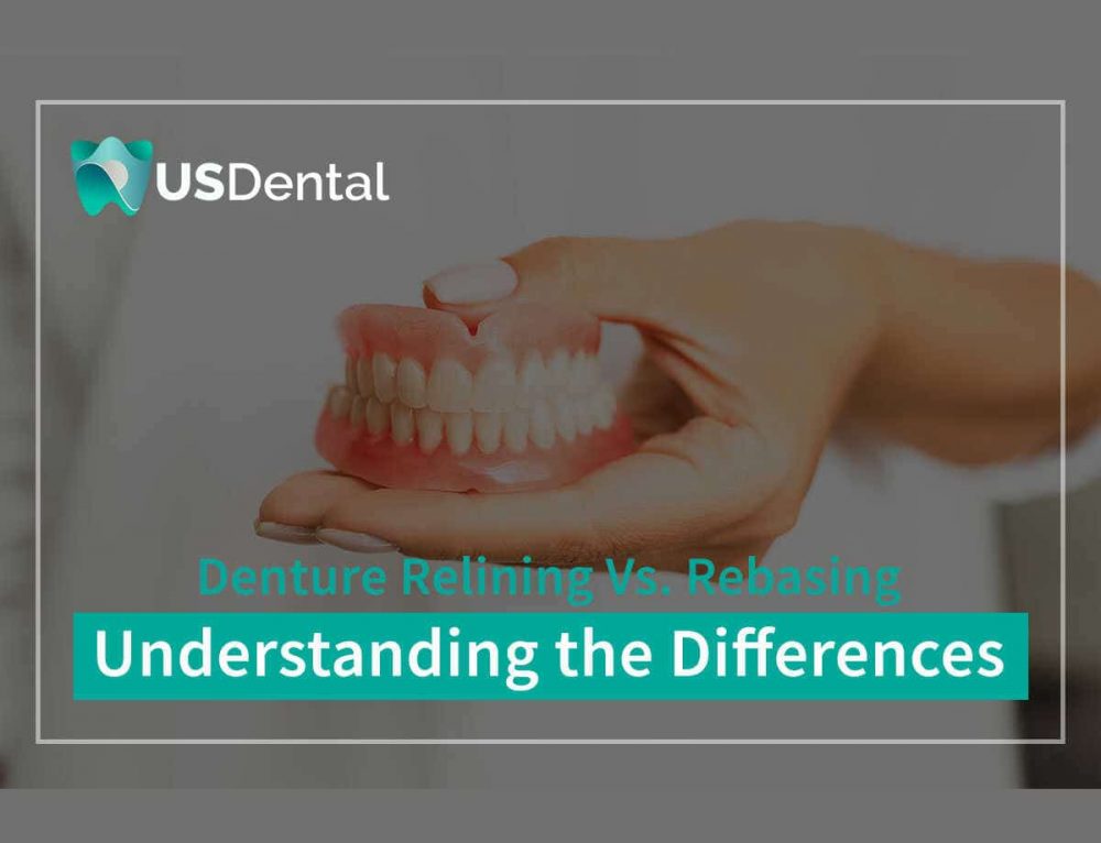 Can You Get Your Teeth Pulled & Dentures In The Same Day?