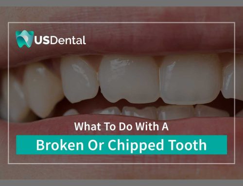 What To Do With A Broken Or Chipped Tooth