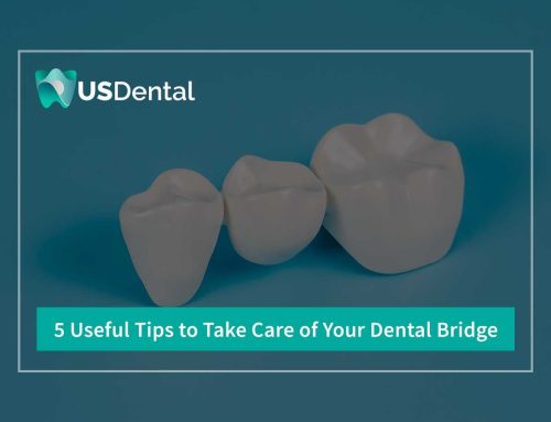 5 Useful Tips To Take Care Of Your Dental Bridge