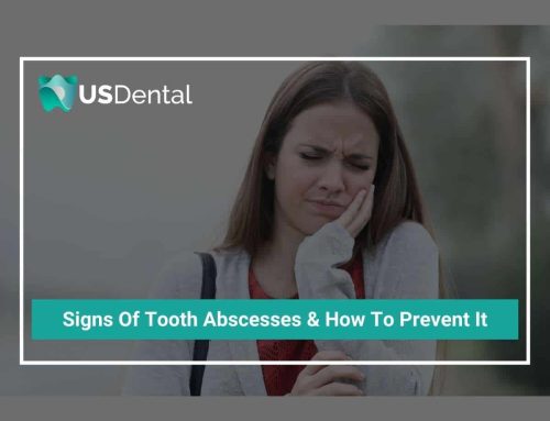 Signs Of Tooth Abscesses & How To Prevent It