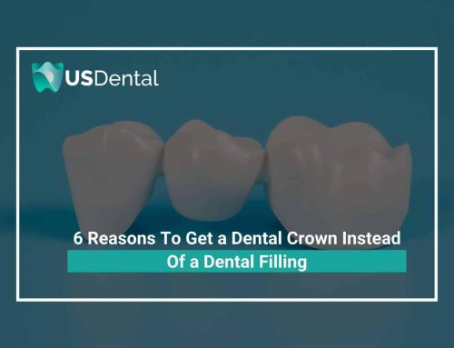 6 Reasons To Get a Dental Crown Instead Of a Dental Filling