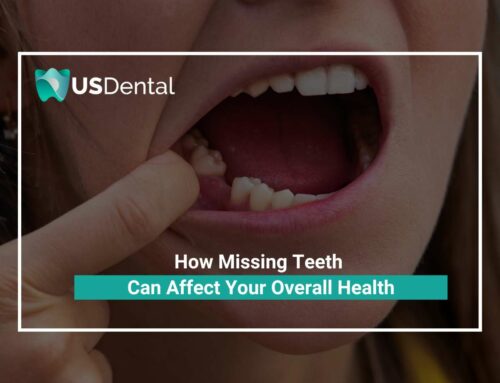How Missing Teeth Can Affect Your Overall Health