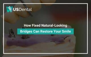How Fixed Natural-Looking Bridges Can Restore Your Smile