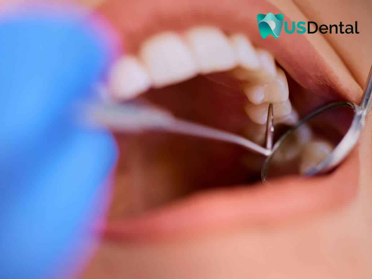 Close-up of a dental check-up focusing on a patient’s dentures